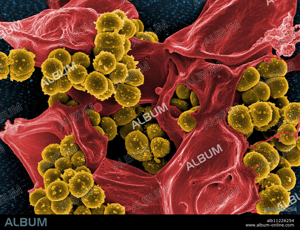 Scanning electron micrograph of methicillin-resistant Staphylococcus aureus and a dead human neutrophil. Credit: NIAID.