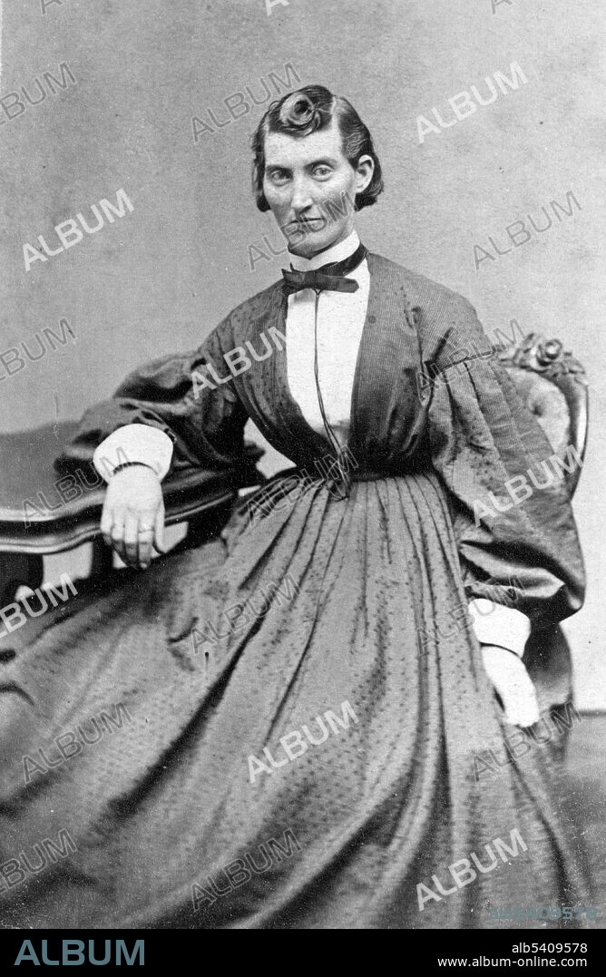 Editorial use only . Frances L. Clayton, 4th Missouri Artillery, wounded in the battles of Shiloh and Stone River. Frances Louisa Clayton (1830s, after 1865), also recorded as Frances Clalin, was an American woman who disguised herself as a man to fight for the Union Army in the American Civil War. Under the alias Jack Williams, she enlisted in a Missouri regiment along with her husband, and fought in several battles. She left the army soon after her husband died at Stones River. Newspaper reports indicate that Clayton served in both cavalry and artillery units. Her story became known and widely circulated after her service, though each account contains contradictory information about her life and service. Several photographs of Clayton, including images of her in uniform, are known to exist. However, little else is known of her life. Unlike other women of the Civil War, Clayton was described by newspapers as tall and masculine-looking. Photographed by Samuel Masury, 1865.
