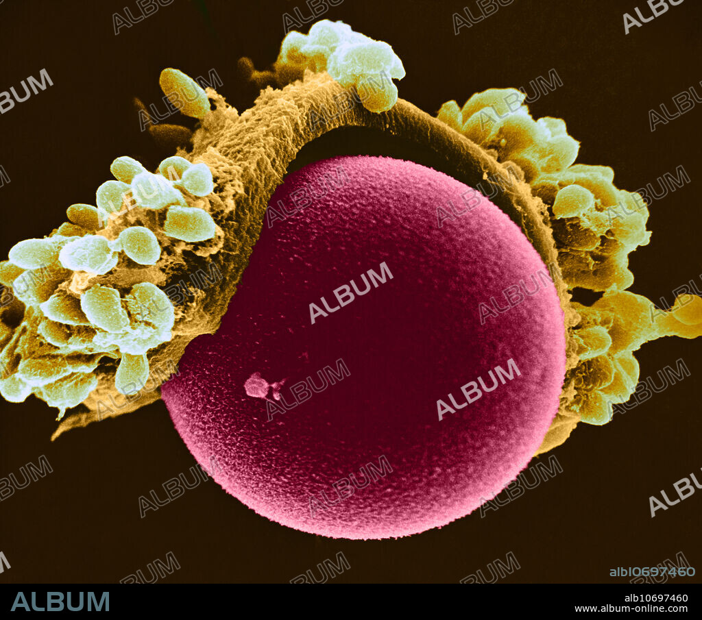 Colour enhanced Scanning Electron Micrograph (SEM) of a hamster egg cell, showing some of the Zona pellucida and cumulus cells, most of which were removed mechanically. Magnification: 2,000X at 8x10 image size.