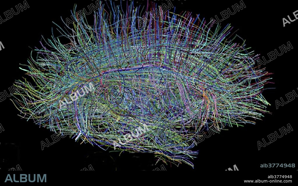Neural fibers in brain image. The NIH Human Connectome Project is an ambitious effort to map the neural pathways that underlie human brain function. The overarching purpose of the Project is to acquire and share data about the structural and functional connectivity of the human brain. It will greatly advance the capabilities for imaging and analyzing brain connections, resulting in improved sensitivity, resolution, and utility, thereby accelerating progress in the emerging field of human connectomics. Altogether, the Human Connectome Project will lead to major advances in our understanding of what makes us uniquely human and will set the stage for future studies of abnormal brain circuits in many neurological and psychiatric disorders. Dated February 1, 2010.
