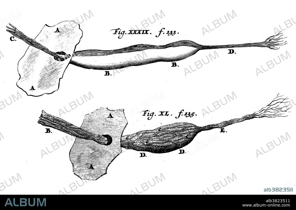 Nuck's canal in dog and human. Drawn by Anton Nuck in the 17th century. Nuck (1650-1692) was a Dutch physician and anatomist. He pioneered the injection of substances into the salivary glands, discovered the the Nuck's diverticulum, the Nuck canal, and the Nuck cyst, which all bear his name. The canal of Nuck, first described by Nuck in 1691 is an abnormal patent (open) pouch of peritoneum extending into the labia majora of women. It is analogous to the processus vaginalis in males (see hydrocele). In rare cases, it may give rise to a cyst or a hydrocele in women. The pouch accompanies the gubernaculum during development of the urinary and reproductive organs, more specifically during the descent of the ovaries, and normally obliterates.