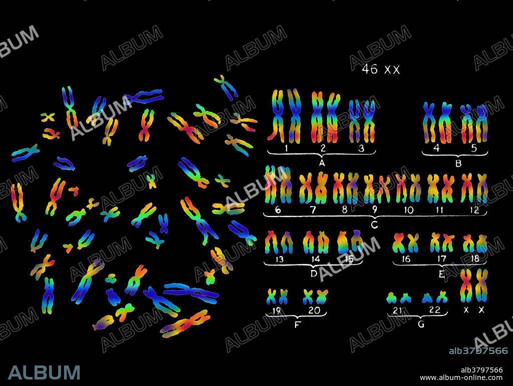 Colour enhanced micrograph of a karyotype of full complement (22 pairs + XX) of normal, female (human) chromosomes. The standard human karyotype shows 22 pairs of autosomal chromosomes and one pair of sex chromosomes (female: 46, XX, male: 46, XY).