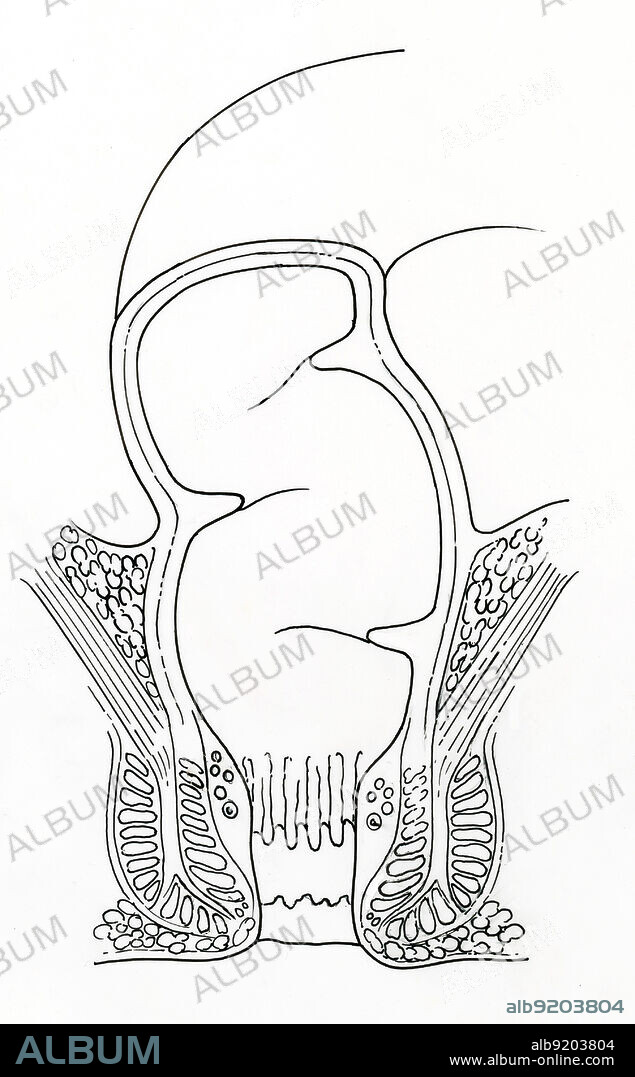 Anatomical illustration of rectum in frontal section, showing anus, anal canal, sphincter muscle, anal columns, levator ani muscle, internal rectum, and transverse fold.
