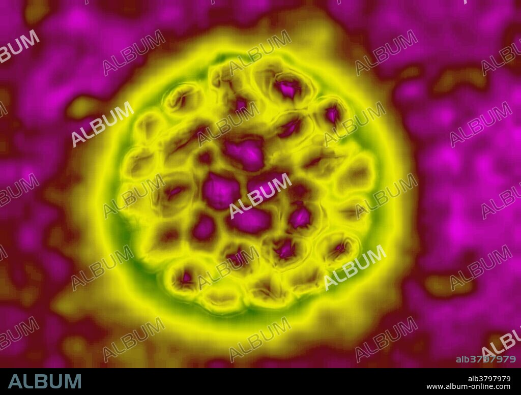 TEM of Polyomavirus