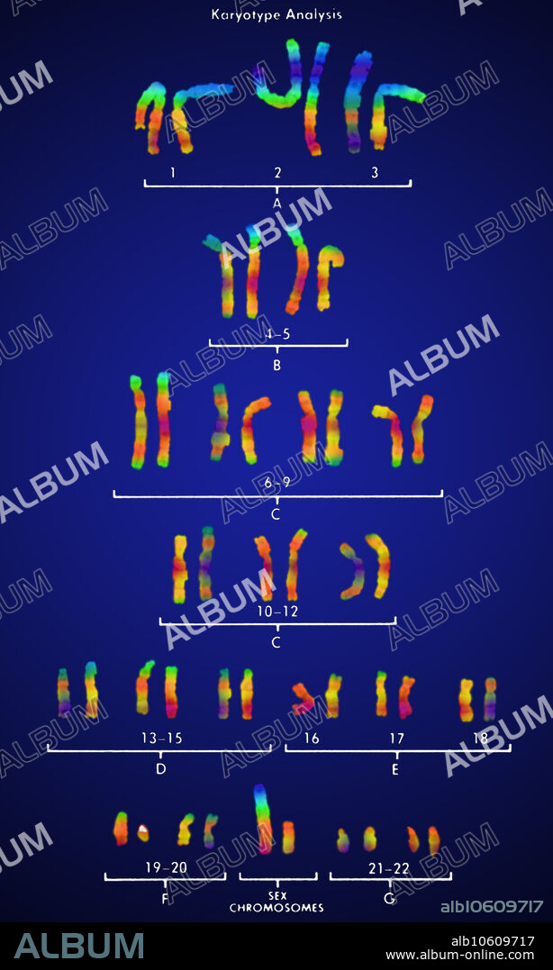 Colour enhanced micrograph of a normal male karyotype; male chromosomes arranged in homologous pairs. Each member of a homologous pair is similar in length and banding pattern. Certain genetic disorders can be identified by detection of abnormal gene products. Each human cell contains 46 chromosomes in total, 23 of maternal and 23 of paternal origin. An extra chromosome signifies a genetic abnormality.