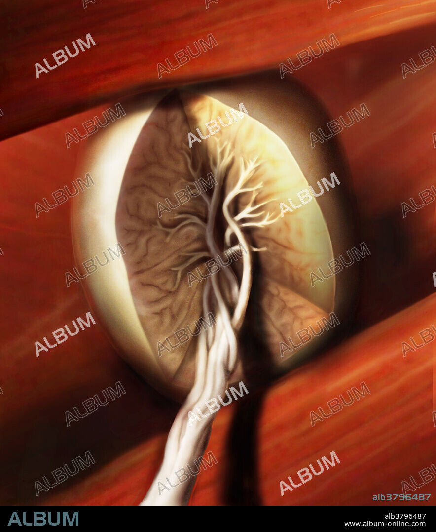 Cross-section of a Cowpers gland (bulbourethral gland), composed of several lobules, each opening into a duct. All of the ducts join together outside of the gland to form a single excretory duct through which lubricating secretions enter the urethra. The Cowpers gland produces a thick, clear mucus that is released prior to ejaculation to neutralize traces of acidic urine within the urethra.