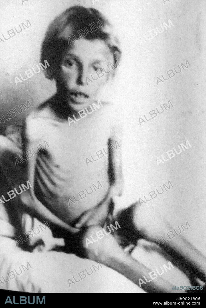 Photograph of a young emaciated Holocaust survivor. The Holocaust, also referred to as the Shoah, was a genocide during the Second World War in which some six million European Jews were murdered.