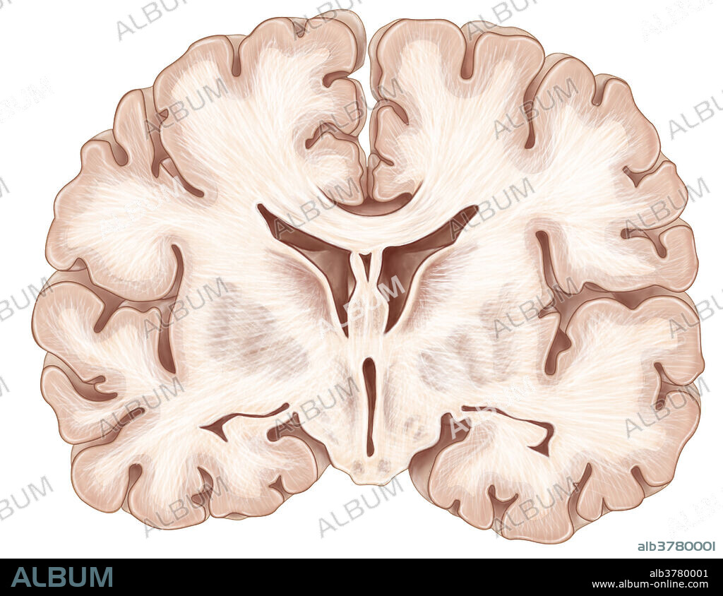 An illustration of a coronal (frontal) section of the brain.