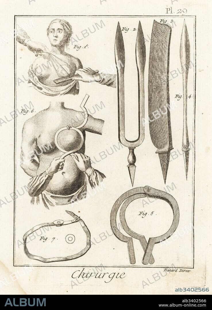Cruel and imperfect breast amputation 1, surgical tongs 2, mastectomy razor 3, mastectomy scalpel 4, breast clamp 5, clamp in use 6 and hernia bandage 7.. Copperplate engraving by Robert Benard from Denis Diderot's Encyclopedia, Pellet, Geneva, 1779.