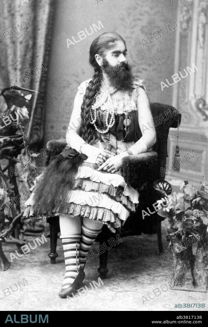 Annie Jones Elliot (July 14, 1865 - October 22, 1902) was an American bearded woman. She toured with showman P. T. Barnum as a circus attraction. Whether the cause of her condition was hirsutism or an unrelated genetic condition that affects children of both sexes and continues into adult years is unknown. Many photographers, including Mathew Brady, took her portraits during her lifetime, which were widely distributed. When Jones joined Barnum's exhibition as a child of only nine months, her parents received a $150/week salary. She was billed as a new "infant Esau." By the age of five, she had a mustache and sideburns and became well known as the "Bearded Girl." Photographer Mathew Brady took Jones' portrait as a child in 1865. As an adult, she became the country's top "bearded lady" and acted as a spokesperson for Barnum's "Freaks", a word she tried to abolish from the business. Jones married Richard Elliot in 1881, but divorced him in 1895 for her childhood sweetheart William Donovan, who died, leaving Jones a widow. She died In 1902, at the age of 37, of tuberculosis. No photographer credited, undated.