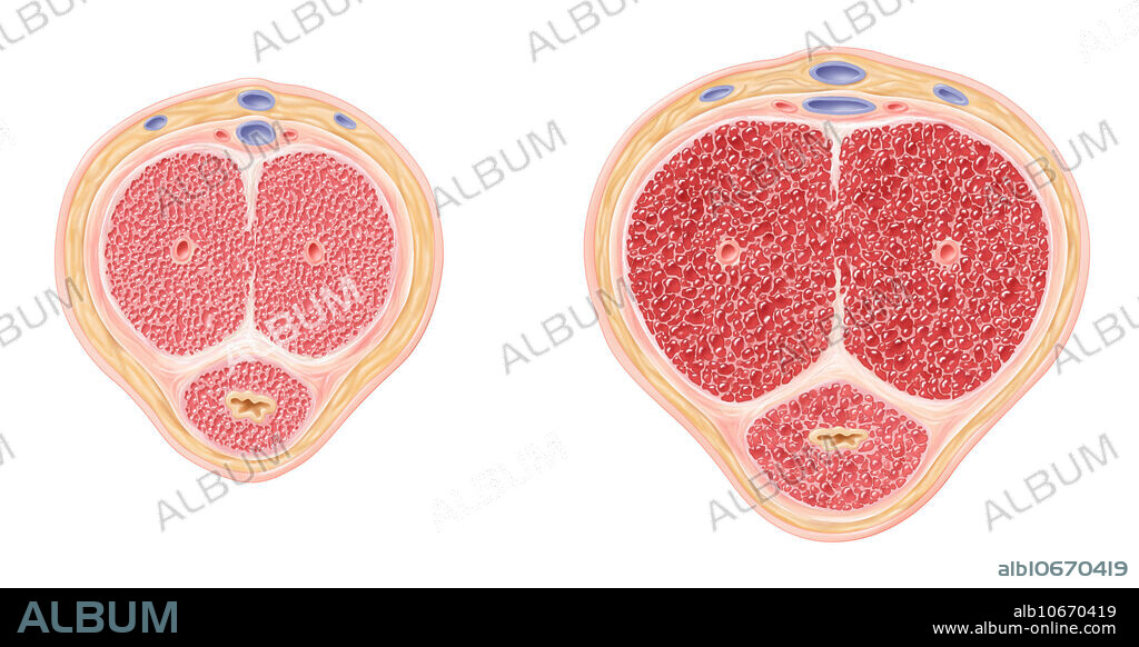 Illustration of a flaccid penis on the left and erect penis on the right.
