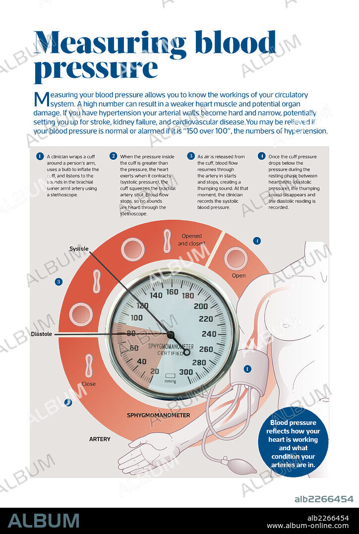 Medir la presión arterial. Infografía sobre la presión arterial y su medición con el esfigmomanómetro.