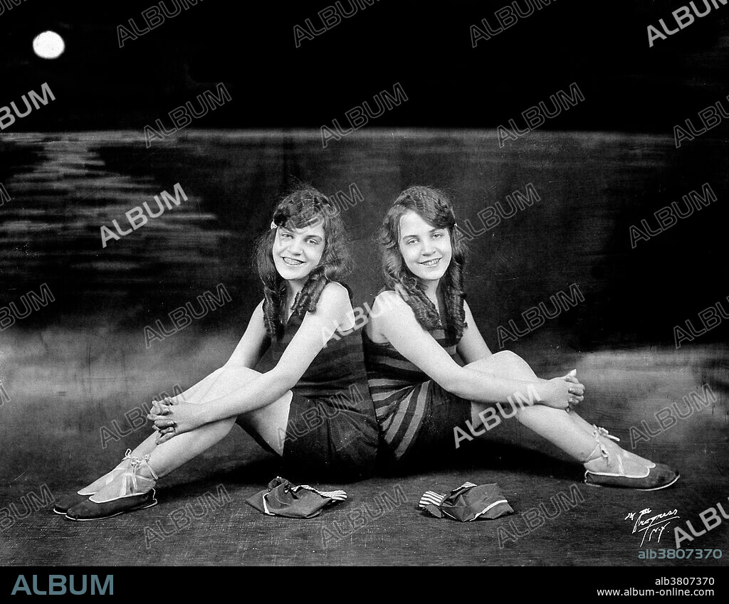 Entitled: "Daisy and Violet Hilton, conjoined twins, dressed in swimsuits." Daisy and Violet Hilton (February 5, 1908 - January 4. 1969) were a pair of English Siamese Twins, joined by their hips and buttocks; they shared blood circulation and were fused at the pelvis but shared no major organs. Their mother worked in a bar and sold the twins to her boss, who toured them around the world. They gained recognition in Germany, the US and Australia and tap danced in a Bob Hope act. They gained independence in 1931 and went into vaudeville. Violet was a saxophonist and Daisy a violinist. After vaudeville lost popularity, the sisters performed in burlesque, and struggled to make a living. Their last public appearance was in 1961 at a drive-in cinema in Charlotte, North Carolina. Their manager abandoned them there, and with no means of transportation or income, they were forced to take a job in a nearby grocery store. In 1969, after they failed to report to work, their boss called the police. The twins were found dead in their home, victims of the Hong Kong flu. According to a forensic investigation, Daisy died first; Violet died between two and four days later. They were 60 years old. Progress Studio, New York, 1927.