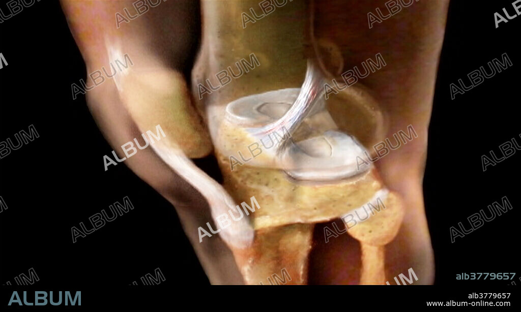 3-D visualization using scanned human data. Knee anatomy, lateral view.