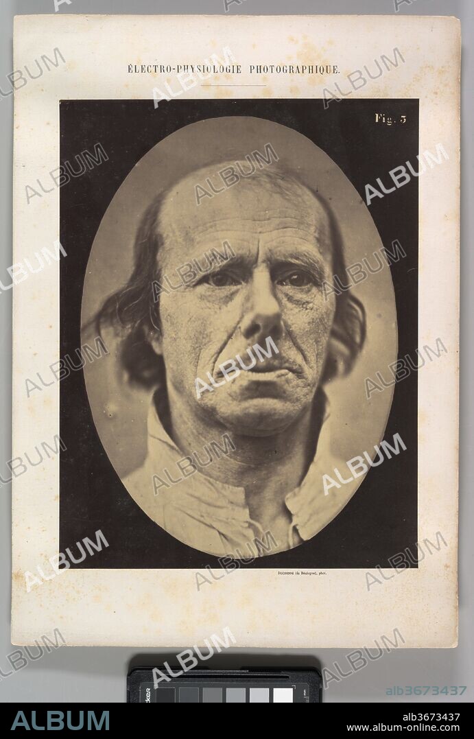 Figure 3: The face of an old man... photographed in repose. Artist: Guillaume-Benjamin-Amand Duchenne de Boulogne (French, 1806-1875); Adrien Tournachon (French, 1825-1903). Dimensions: Image (Oval): 28.3 × 20.3 cm (11 1/8 × 8 in.)
Sheet: 30 × 22.9 cm (11 13/16 × 9 in.)
Mount: 40.1 × 28.4 cm (15 13/16 × 11 3/16 in.). Date: 1854-56, printed 1862.