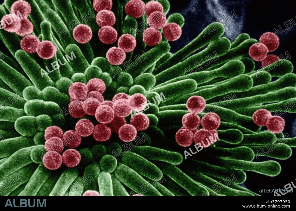 Ragweed pollen. Colored scanning electron micrograph (SEM) of pollen grains (pink) on the stigma (green) of a ragweed plant (Ambrosia sp.). These spiky pollen grains contain the male sex cells of the plant. The multi-lobed stigma, the surface of the flower's female sex organ, the carpel, is where the pollen germinates. Ambrosia sp. is a daisy-like flower which grows in bare and waste ground. Its pollen is wind-borne and released in great quantities for cross-pollination. Ambrosia sp. pollen acts as an allergen causing hay fever (allergic rhinitis or pollinosis) in susceptible individuals. Magnification: x150 at 5x7cm size. Magnification: x75 at 35mm size.