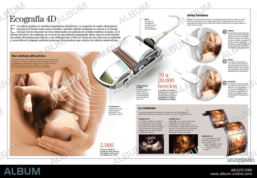 Ecografía 4D. Infografía de la ecografía en cuatro dimensiones, lo último en estudios diagnósticos obstétricos.