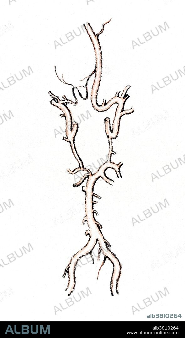 Illustration showing arteries at the base of the brain called the "Circle of Willis". In this image, there is an absence of one of the anterior cerebral arteries (upper left). In its place, slender branches form a communication between the single anterior cerebral artery and the internal carotid of the opposite side. It is an example of a very rare variety. The Circle of Willis (also called Willis' Circle, Loop of Willis, cerebral arterial circle, and Willis Polygon) is a circulatory anastomosis that supplies blood to the brain and surrounding structures. It is named after Thomas Willis (1621-1675), an English physician. Color lithograph, c. 1844, by Joseph Maclise.