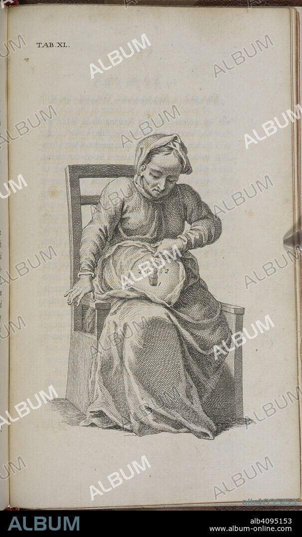 WILLLIAM CHESLEDEN. A woman sitting in a chair examining part of herself. [The anatomy of the human body ... The fourth edition. With the addition of an appendix, etc.]. London : W. Bowyer, 1740. Source: G.19234 Tab.XI.