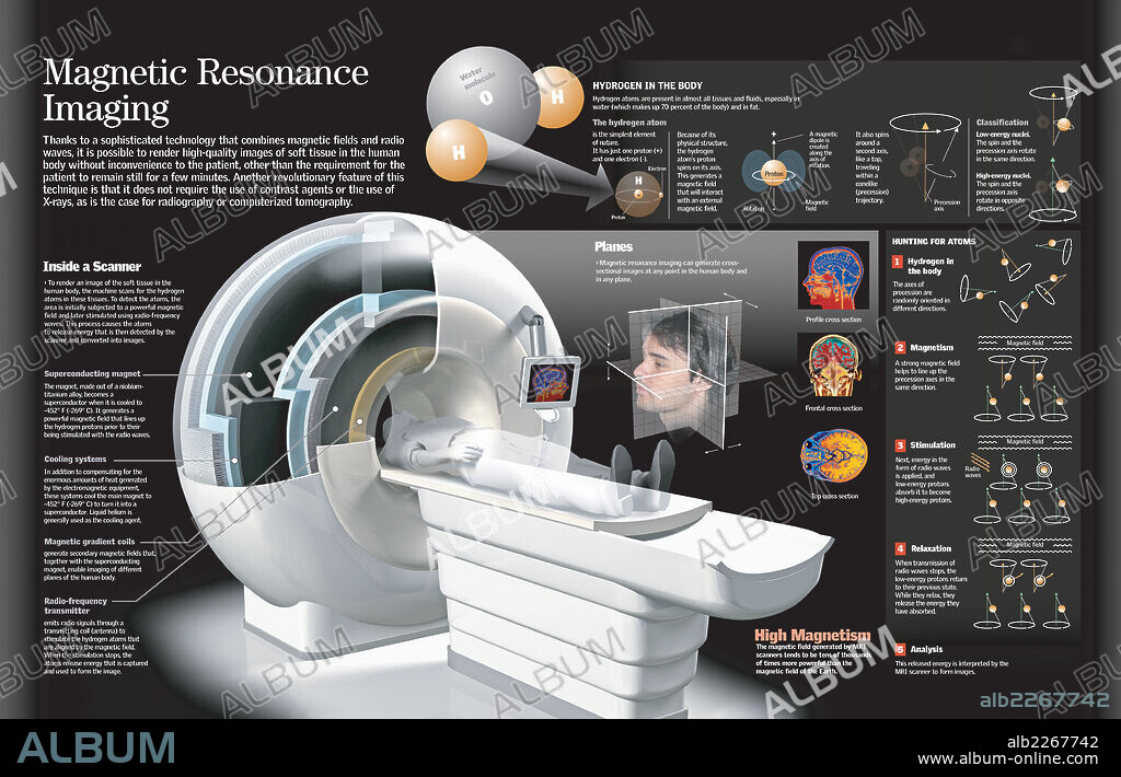 ? Magnetic Resonance Imaging. Infographic of the operation of a scanner for the magnetic resonance and the images of the body tissues.