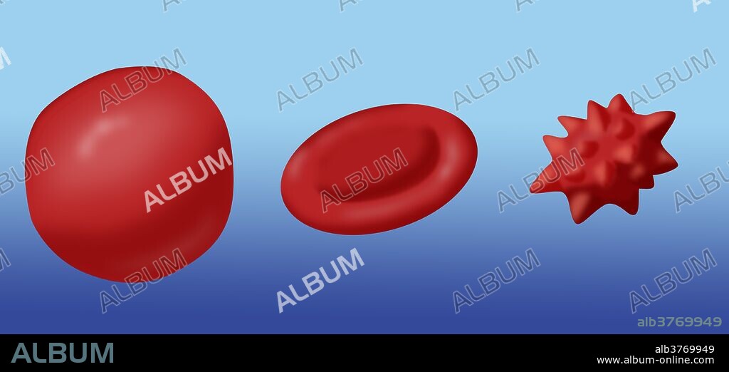 Illustration showing the effect of hypotonic, isotonic and hypertonic solutions on red blood cells.