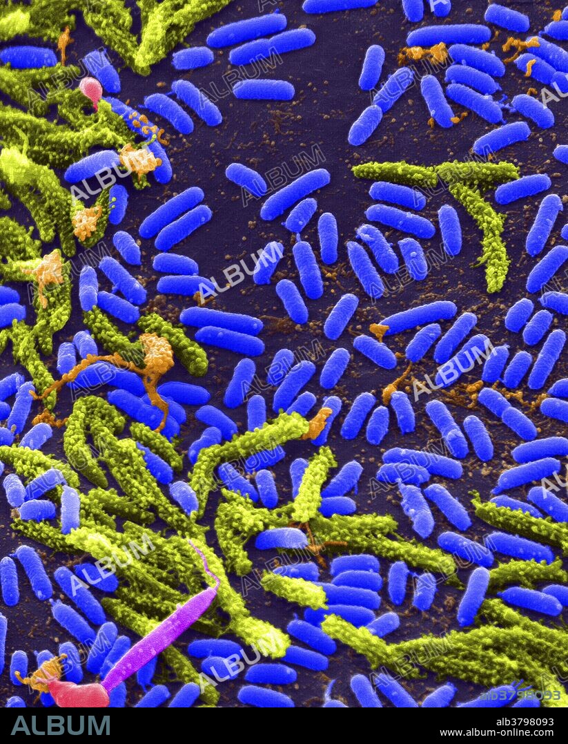 Vibrio, a type (genus) of rod-shaped bacteria. Some Vibrio species cause cholera in humans. Vibrio is a genus of Gram-negative bacteria possessing a curved rod shape (comma shape), several species of which can cause foodborne infection, usually associated with eating undercooked seafood. Typically found in saltwater, Vibrio spp. are facultative anaerobes that test positive for oxidase and do not form spores. All members of the genus are motile and have polar flagella with sheaths. Most disease-causing strains are associated with gastroenteritis, but can also infect open wounds and cause septicemia.
