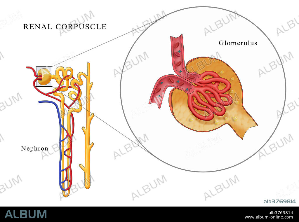 Illustration of the anatomy of a renal corpuscle. At left is the full structure of a nephron and at right is a detailed diagram of kidney glomerulus. Diagram shows the afferent arteriole, bowman's capsule, efferent arteriole, and proximal convoluted tubule.