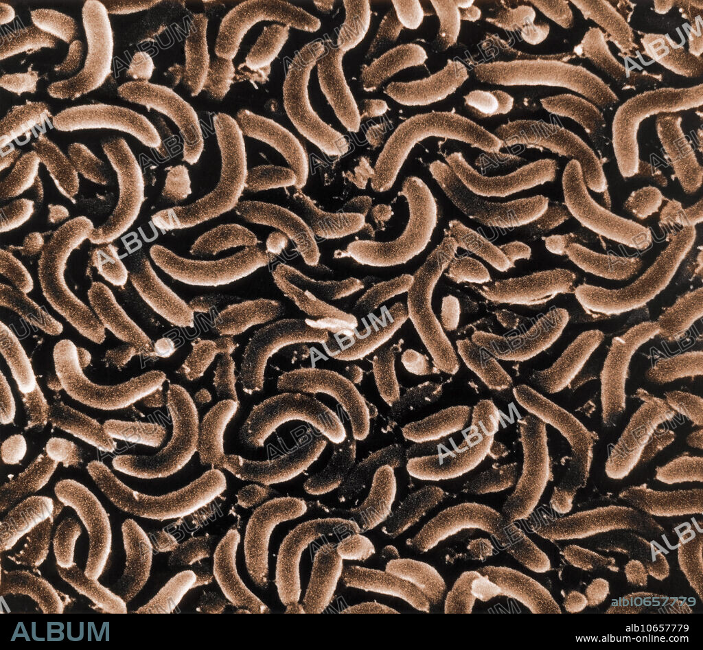 Scanning Electron Micrograph (SEM) of bacteria. Magnification: 19,000X at 8 x 10 print size.
