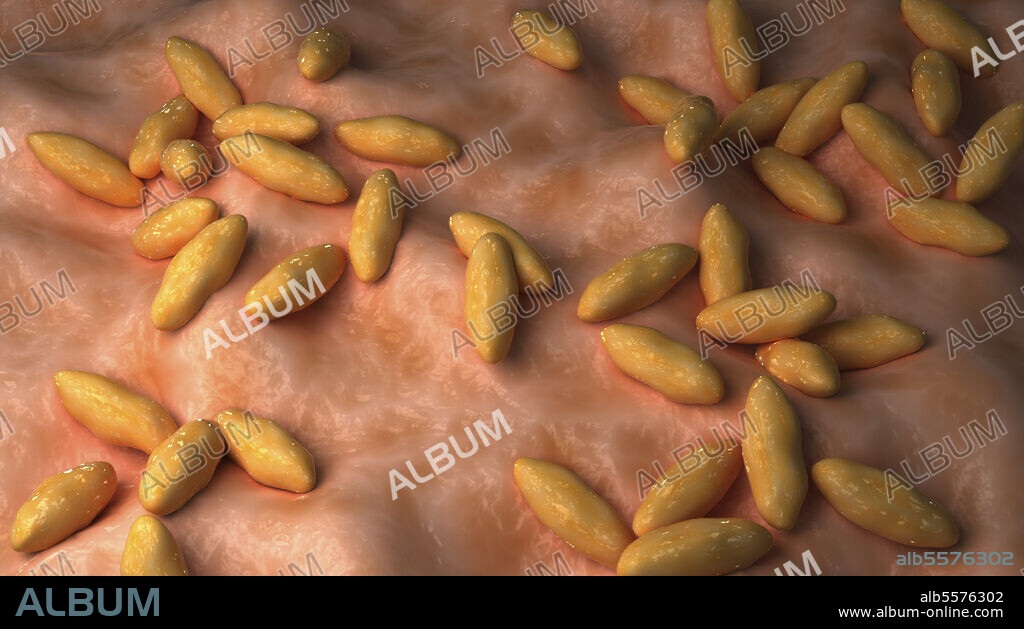 Conceptual biomedical illustration of brucellosis, also known as Malta fever.