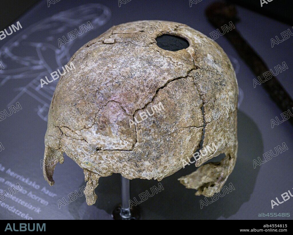 craneo trepanado, siglo X, necrópolis de Mendraka, Elorrio, Arkeologi Museoa, museo aqueologico, Bilbao, Bizkaia, Pais Vasco, Spain.