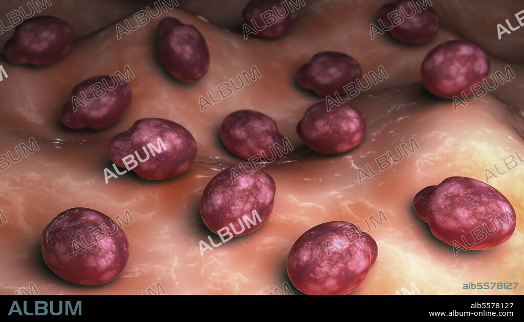 Conceptual biomedical illustration of Malassezia furfur fungus on the skin.