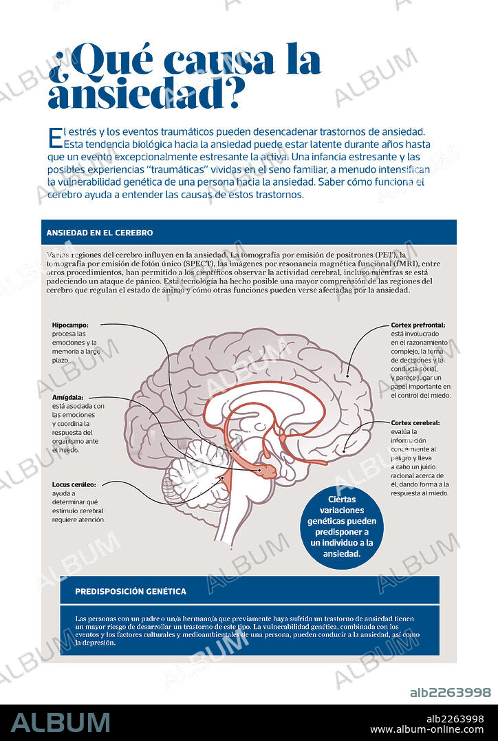 ¿Qué causa la ansiedad?. Infografía sobre cómo la genética, los factores culturales y medioambientales pueden mantener cierta relación con el desarrollo de trastornos como la ansiedad y la depresión.
