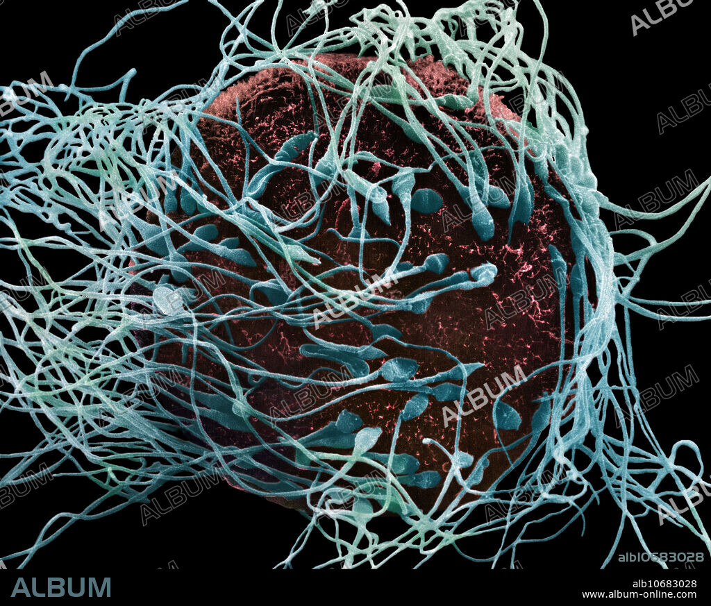 Human Spermatozoa Fertilizing an Egg