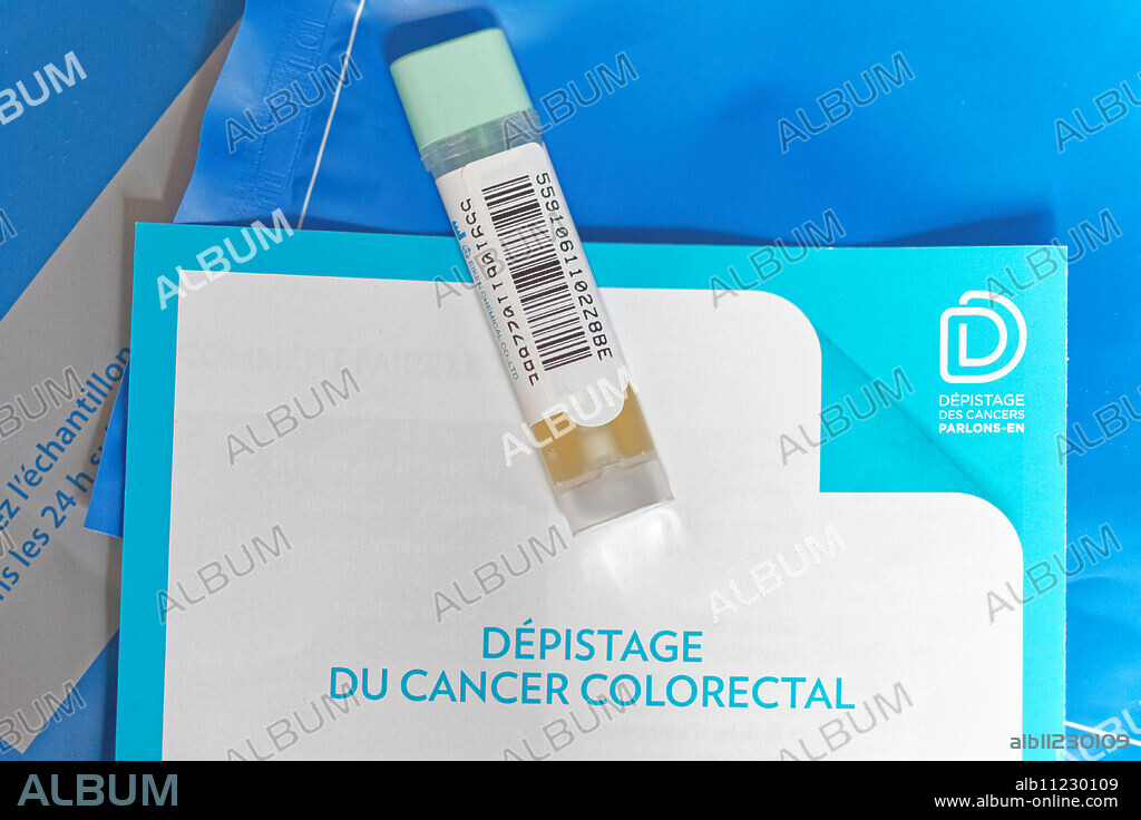 OC-Sensor® colorectal cancer screening test.
