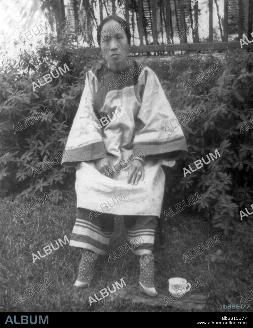 Entitled: "A small-footed Chinese lady, 1905." Foot binding (also known as "Lotus feet") was the custom of applying painfully tight binding to the feet of young girls to prevent further growth. The practice possibly originated among upper-class court dancers during the Five Dynasties and Ten Kingdoms period in Imperial China (10th or 11th century), but spread in the Song Dynasty and eventually became common among all but the lowest of classes. Foot binding became popular as a means of displaying status (women from wealthy families who did not need them to work could afford to have their feet bound) and was correspondingly adopted as a symbol of beauty in Chinese culture. Cropped stereograph card by Stereo by Keystone View Company.