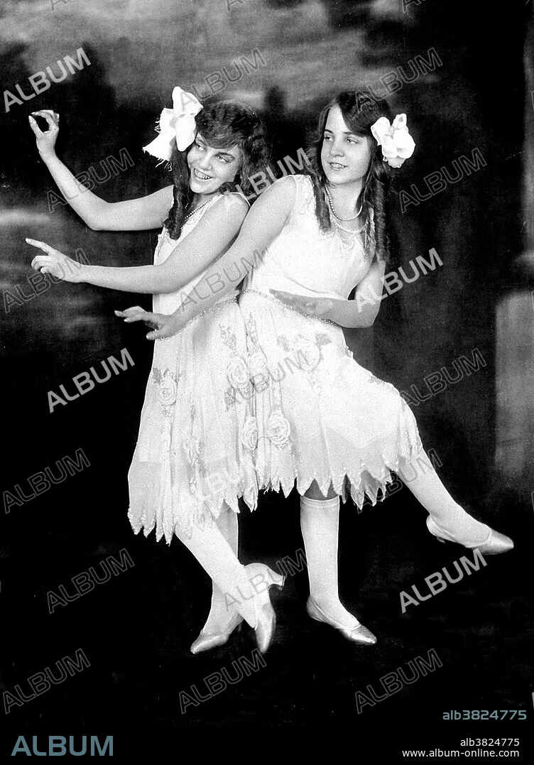 Entitled: "Daisy and Violet Hilton, conjoined twins, dancing." Daisy and Violet Hilton (February 5, 1908 - January 4. 1969) were a pair of English Siamese Twins, joined by their hips and buttocks; they shared blood circulation and were fused at the pelvis but shared no major organs. Their mother worked in a bar and sold the twins to her boss, who toured them around the world. They gained recognition in Germany, the US and Australia and tap danced in a Bob Hope act. They gained independence in 1931 and went into vaudeville. Violet was a saxophonist and Daisy a violinist. After vaudeville lost popularity, the sisters performed in burlesque, and struggled to make a living. Their last public appearance was in 1961 at a drive-in cinema in Charlotte, North Carolina. Their manager abandoned them there, and with no means of transportation or income, they were forced to take a job in a nearby grocery store. In 1969, after they failed to report to work, their boss called the police. The twins were found dead in their home, victims of the Hong Kong flu. According to a forensic investigation, Daisy died first; Violet died between two and four days later. They were 60 years old. Progress Studio, New York, 1927.
