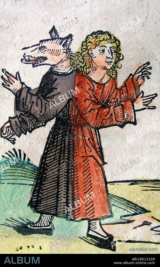 Woodcut of a monster, half human, half dog, in the form of Siamese twins (CXCVIII recto) from the Nuremberg Chronicle. The Nuremberg Chronicle is an illustrated Biblical paraphrase and world history that follows the story of human history related in the Bible; it includes the histories of a number of important Western cities. Written in Latin by Hartmann Schedel, with a version in German translation by Georg Alt, it appeared in 1493. It is one of the best documented early printed book, an incunabulum, and one of the first to successfully integrate illustrations and text. Conjoined twins are identical twins born with their bodies joined at some point and having varying degrees of residual duplication, a result of the incomplete division of the ovum from which the twins developed.