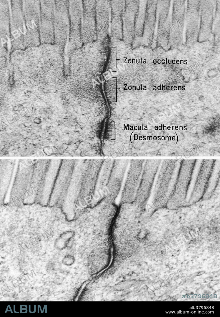 Epithelial junctional complex (labeled & unlabeled). Composed of the zonula occludens (tight junction), the zonula adherens (intermediate junction), and the macula adherens (desmosome). The zonula occludens is a belt-like specialization in which the adjacent unit membranes converge and fuse, obliterating the intercellular space over variable distances. The membranes commonly fuse at multiple levels within the zonula to form local pentalaminar regions separated by short segments in which the membranes are closely opposed, but not fused. At the zonula adherens, the membranes course parallel over a distance of 0.2 to 0.5 micrometers, and are separated by a 25 nanometer of interstellar space. The cytoplasm immediately subjacent to the membranes is relatively dense, and is the site of insertion of the transversely oriented filaments comprising the so-called "terminal web." The desmosome (macula adherens) is the third component of the complex. It consists of parallel segments of the opposing membranes, reinforced by dense plaques, and separated by aan interspace of about 25 nanometers, which is often bisected by a thin, dense line.