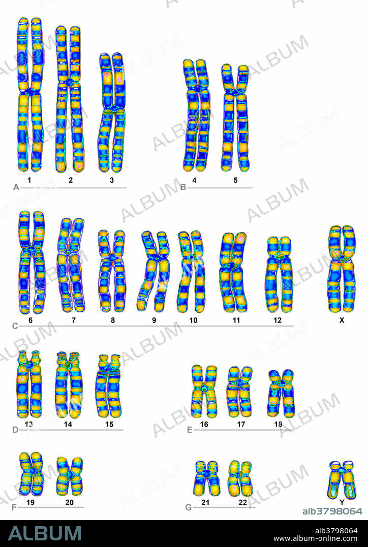 Human chromosomes. The human karyotype is composed of 23 pairs of chromosomes, including 1 pair of sexual chromosomes (XX for the female, XY for the male). The chromosomes carry genetic information, formed by a long DNA molecule, associated with proteins. They can be organized in seven groups (A through G) according to the Denver classification (by size and position of the centromere as determined during mitotic metaphase). Illustration of microscopy. Magnification: 3900x per 10 cm.