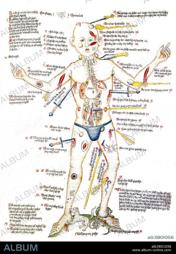 Wound man with injuries, legend in German, 1420s. Wound Man is an illustration which first appeared in European surgical texts in the Middle Ages. The wound man laid out schematically the various wounds a person might suffer in battle or in accidents, often with surrounding or accompanying text stating treatments for the various injuries. Wound man was used often in surgical texts throughout the 16th century and even into the 17th century. Despite these injuries the wound man is still depicted as standing defiantly alive. The purpose of wound man is not to appear as a threatening figure or to make the viewer fearful of his injuries, but rather reveal potential cures and medical treatments available at the time. Wound man has since become a recognizable figure in popular culture.