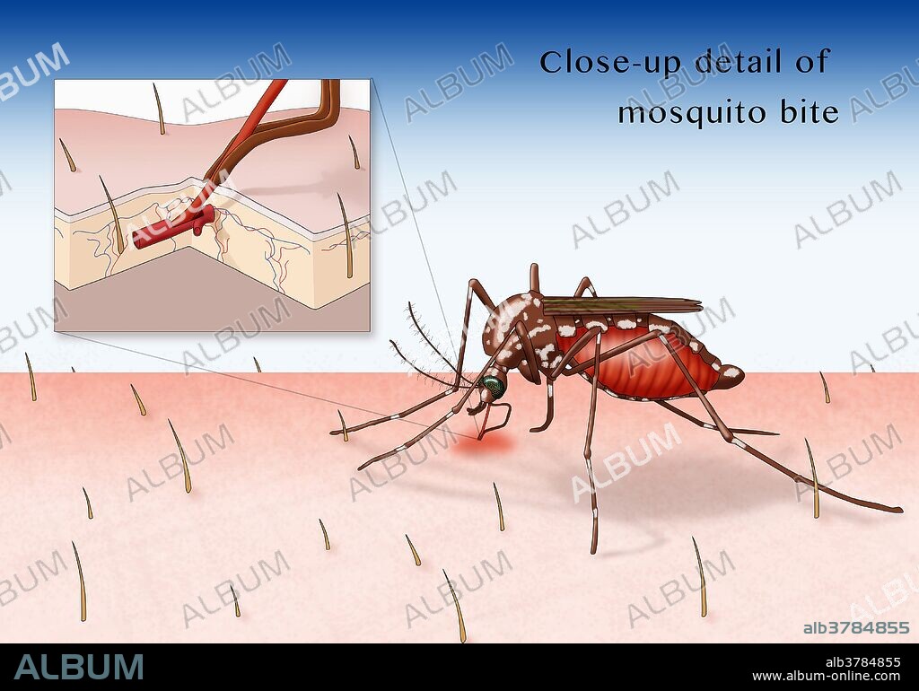 Illustration of a mosquito drawing blood through the skin.