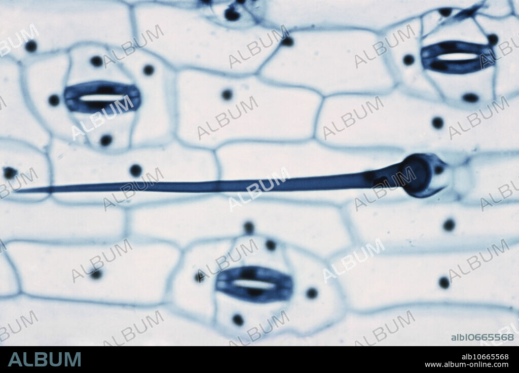 Light micrograph of leaf epidermis in Tradescantia; stomata and hair.
