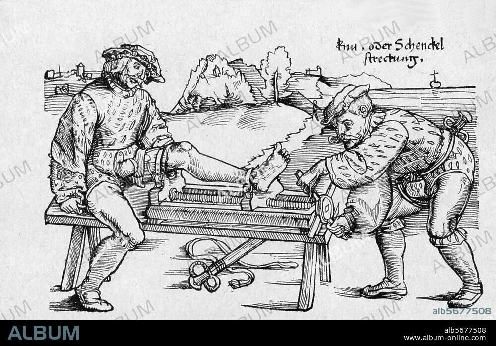 Medizin:. Strecken. Knie- oder Schenkelstreckung mittels eines Apparates. Holzschnitt. Aus: H. von Gersdorf, Feldtbuch der Wundartzney, Straßburg (Johann Schott). 1528.