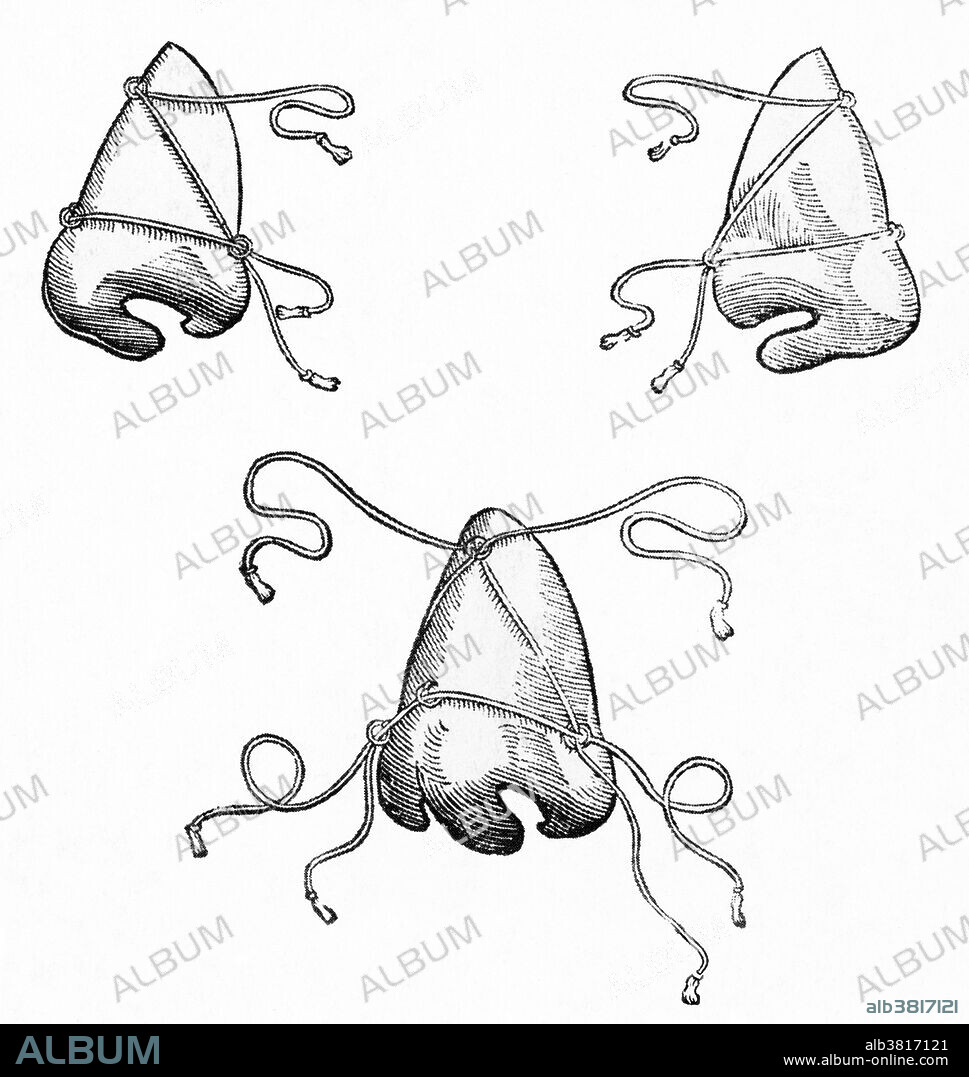 Masks to hold a nose in place after an operation.  Illustration from Gaspare Tagliacozzi's book on plastic surgery, De Curtorum Chirurgia Per Institionem (1597). Tagliacozzi (1547-1599) was an Italian plastic surgeon.  Although reconstructive surgery had been practiced for years, with documented procedures in ancient India, Tagliacozzi popularized the field, and particularly rhinoplasty, in the 16th century.