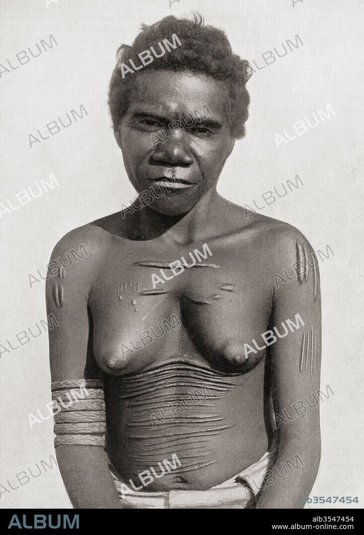 Cicatrization or scarification. The custom of making scars on the body. In this case the subject is an Australian Aboriginal woman. Scars are often considered to improve personal appearance, but they can also represent personal, social or religious information. After a 19th century photograph. From Customs of The World, published c.1913.