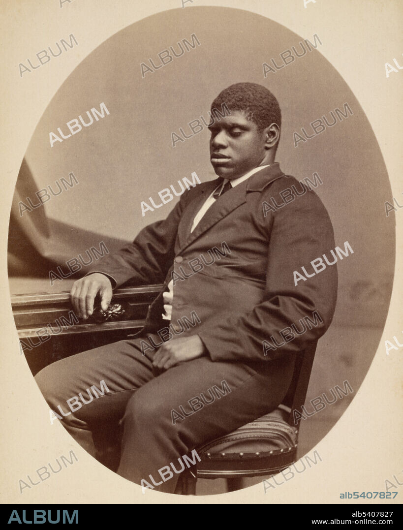 Thomas "Blind Tom" Wiggins (1849-1908) in 1882. Blind Tom was an African-American musical prodigy and one of the most celebrated African American concert artists of the nineteenth century. Blind from birth and possibly autistic, Tom was only four when he began performing tunes he had heard played on the piano of the man who enslaved him, James Bethune. Tom made his professional debut as a pianist in 1857, at the age of eight, and was soon earning a fortune for Bethune with engagements throughout the country. When the Civil War began, Tom was returned to Georgia and compelled to play benefit concerts for the Confederate cause. To protect his financial interest in Tom, Bethune obtained legal guardianship of the teenager. This effectively prevented him from ever securing his freedom. Albumen silver print by George Kendall Warren.