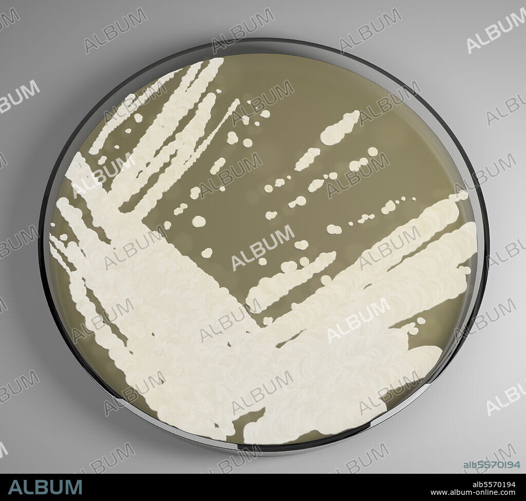 3D model of Candida auris growing in a petri dish.