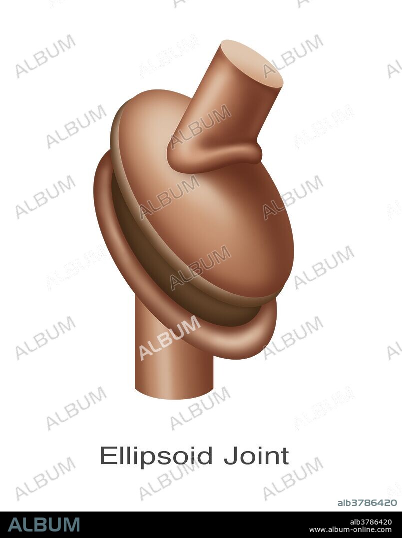 Illustration of an ellipsoid joint replacement.