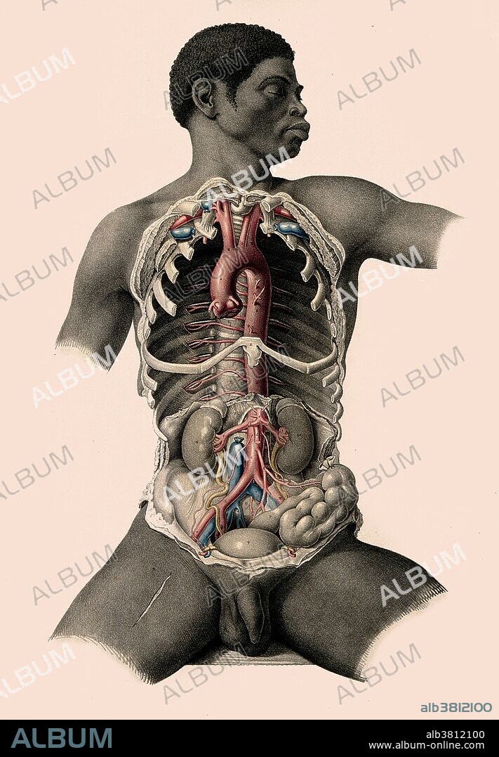 Dissection of the torso of a seated black man, showing major blood vessels. Colored lithograph by Joseph Maclise, 1851.