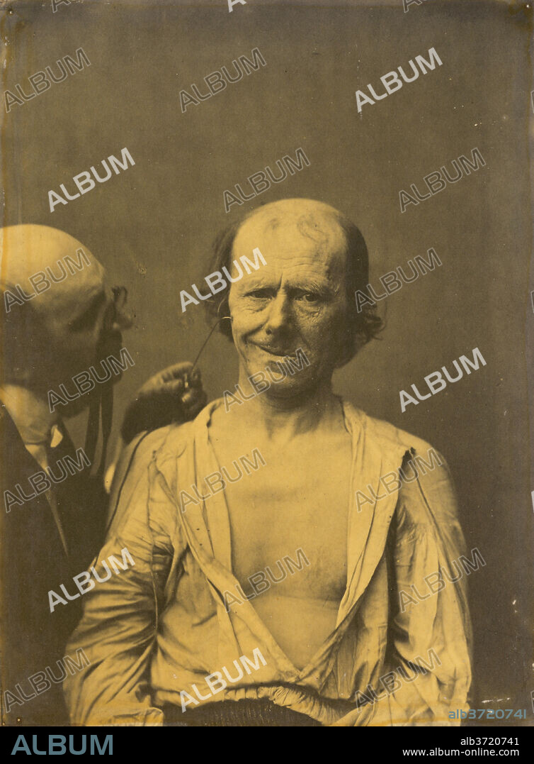 GUILLAUME-BENJAMIN-AMANT DUCHENNE (DE BOULOGNE). A relaxed face (left); False joy or laughter (right), plate 30 from the album, The Mechanism of Human Facial Expression. Dated: 1854-1856. Dimensions: image: 22.7 × 16.8 cm (8 15/16 × 6 5/8 in.)  mount: 42 × 27.4 cm (16 9/16 × 10 13/16 in.). Medium: albumen print, printed 1862.